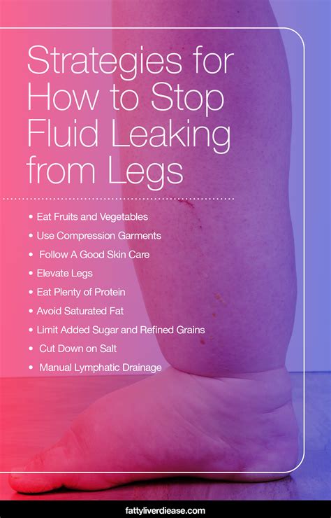 legs leaking fluid|7 Tips For Managing Leaky Legs 